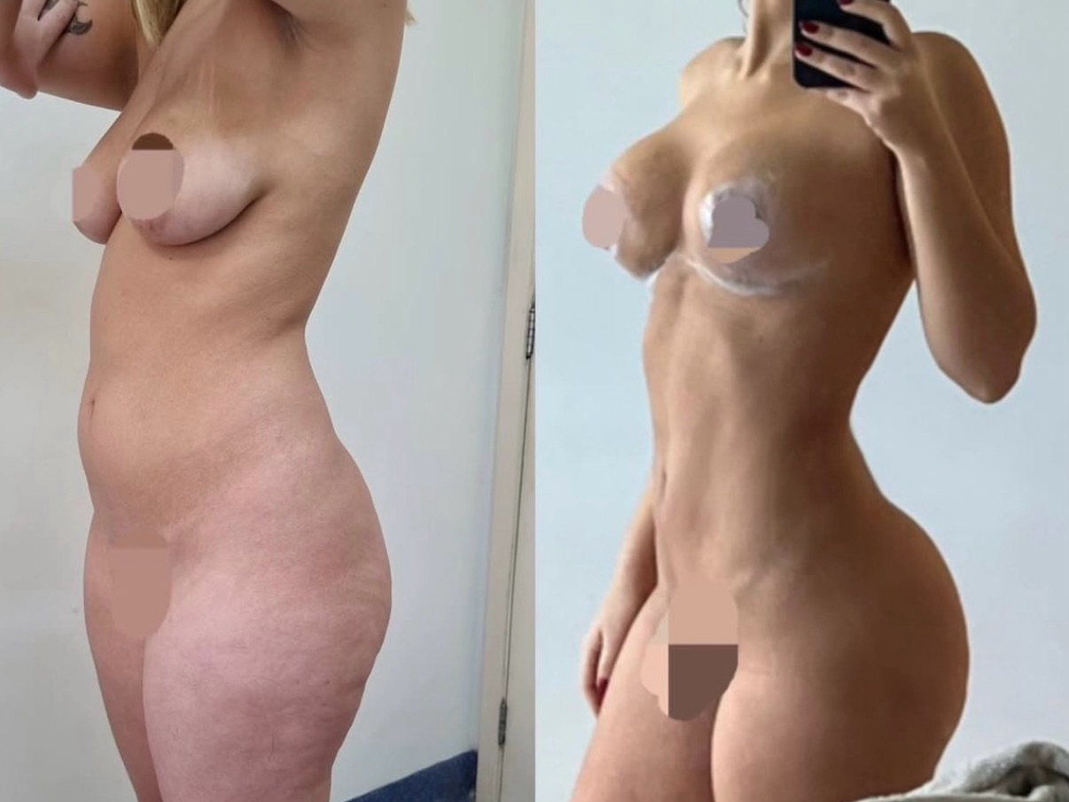 Contorno corporal — perfil