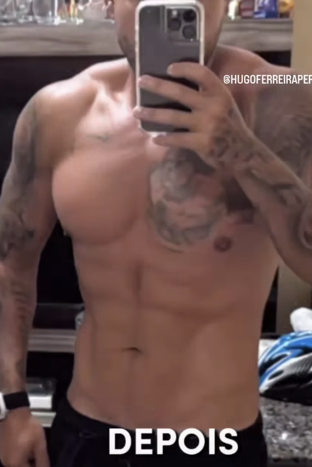 Lipo HD masculina — depois